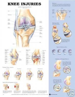 Knee Injuries Anatomical Chart/Charts/Model